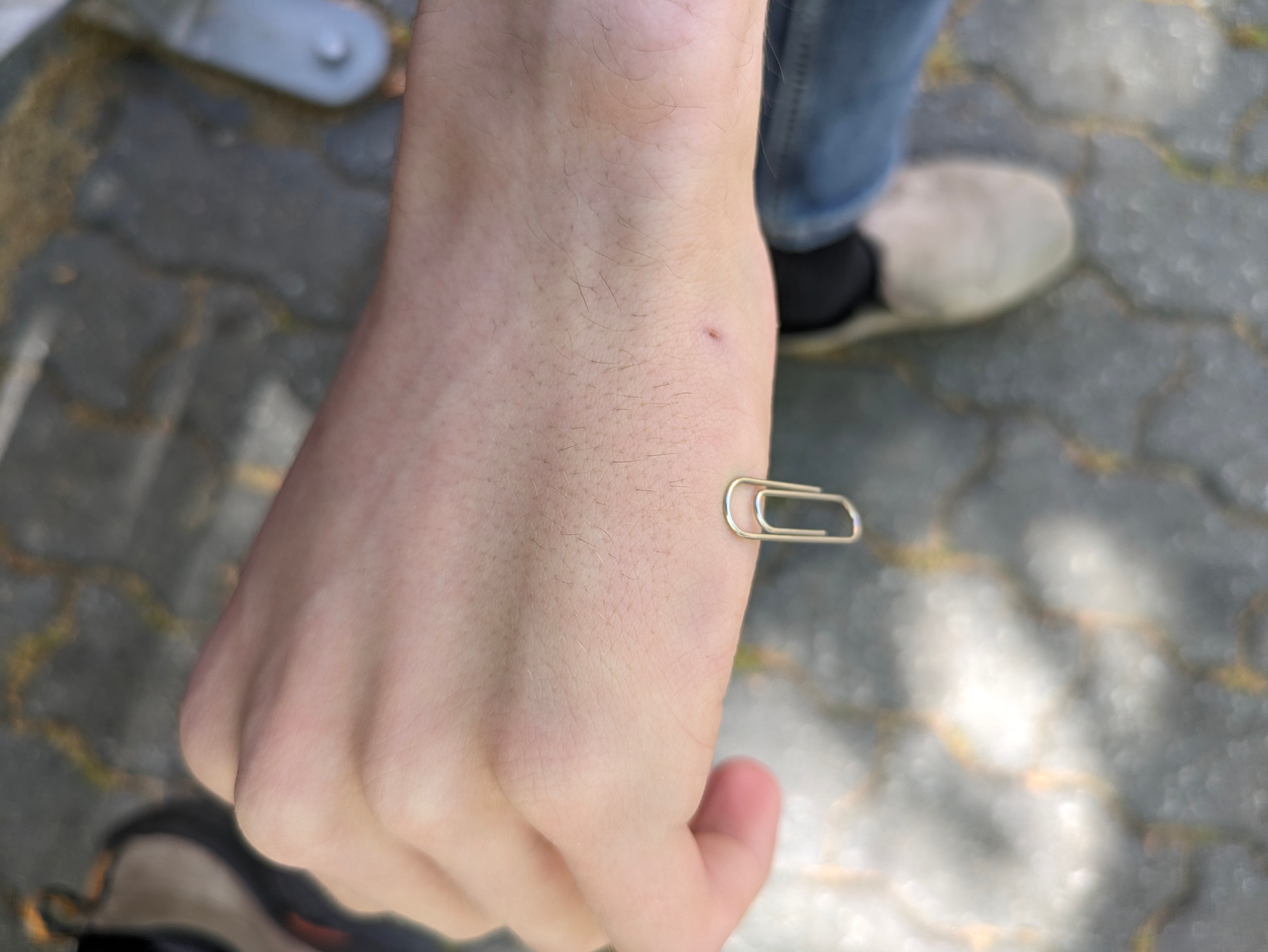 My hand, with a paper clip stuck to it halfway along the side between my pinky and wrist.